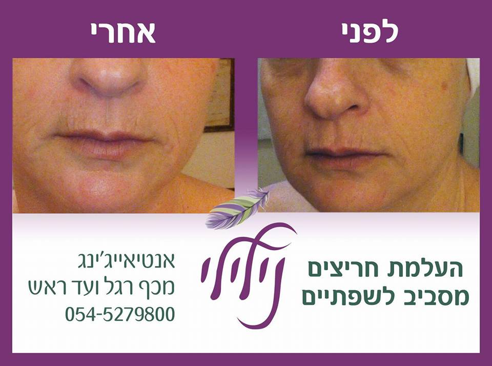 13707698_10154298319269424_583941297156585764_n