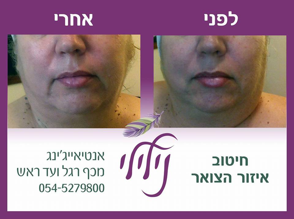 13775574_10154298303729424_8987522568737358712_n